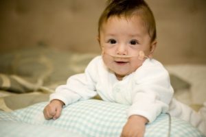 baby resting on a pillow with tubes in its nose