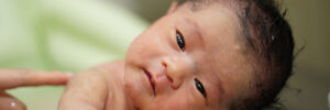 baby with torticollis