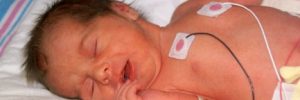 NICU infant premature baby