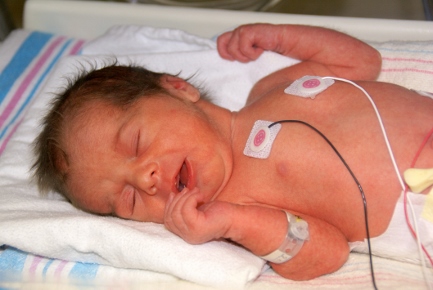 Therapeutic Interventions in the NICU - Education Resources