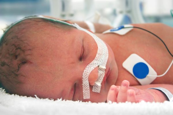 Complex infant neonate in NICU, PICU and SICU