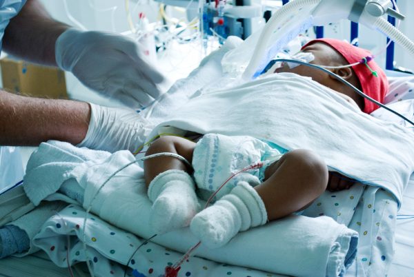 premature infant in NICU medically complex