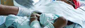 premature infants with complex neurological diagnoses in NICU