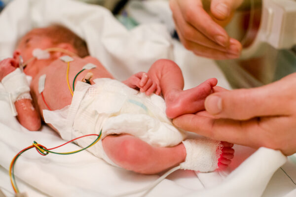 NICU premature infant neonatal