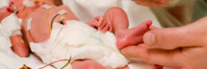 NICU neonatal infant premature baby